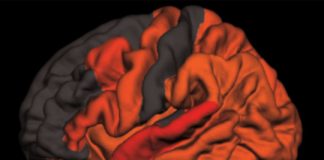 Study: Toxic brain protein tau elevated in older people who sleep poorly — (Details)