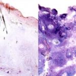 Study: Tumors not as addicted to glucose as previously thought — (Details)