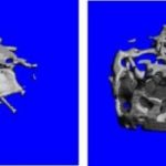 Study: After blocking estrogen signals in brain, experts say they’ve ‘never seen bone this strong’ — (Details)