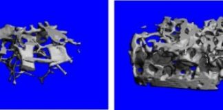 Study: After blocking estrogen signals in brain, experts say they’ve ‘never seen bone this strong’ — (Details)