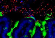 Research: Gut microbes from healthy infants block milk allergy development in mice —