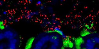 Research: Gut microbes from healthy infants block milk allergy development in mice —