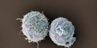 Study: Engineered T cells promote long-term organ transplant acceptance — (Details)