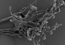 Research: How Candida albicans exploits lack of oxygen to cause disease —