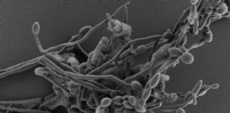 Research: How Candida albicans exploits lack of oxygen to cause disease —