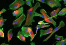 Research: Research team finds that mesenchymal progenitors can be grown without use of animal-derived compounds —