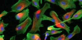 Research: Research team finds that mesenchymal progenitors can be grown without use of animal-derived compounds —