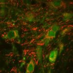 Study: Just not on cocaine — (Details)