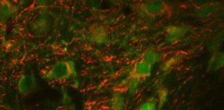 Study: Just not on cocaine — (Details)