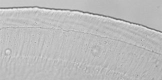 Study: A critical gel-like structure in the inner ear moves according to a sound’s frequency, researchers find — (Details)