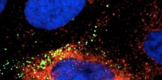 Study: Cellular protein a target for Zika control — (Details)