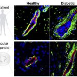 Study: Breakthrough technology advances research of vascular diseases like diabetes — (Details)