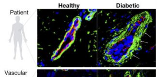 Study: Breakthrough technology advances research of vascular diseases like diabetes — (Details)