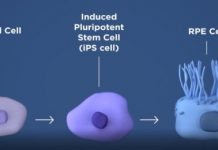 Research: Findings set stage for first clinical trial of stem cell-based therapeutic approach for AMD —