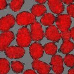 Study: Insulin-producing cells more responsive to fluctuating glucose levels — (Details)