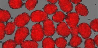 Study: Insulin-producing cells more responsive to fluctuating glucose levels — (Details)