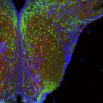 Study: Scientists are piecing together how genes involved in neural development can affect body weight — (Details)