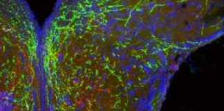 Study: Scientists are piecing together how genes involved in neural development can affect body weight — (Details)