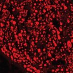 Study: Lays groundwork for developing treatments for peripheral neuropathy, other nerve diseases — (Details)