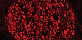 Study: Lays groundwork for developing treatments for peripheral neuropathy, other nerve diseases — (Details)