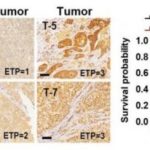 Study: New therapeutic avenue in the fight against chronic liver disease — (Details)