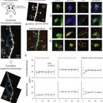 Study: Synaptic logic for connections between two brain hemispheres — (Details)