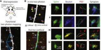 Study: Synaptic logic for connections between two brain hemispheres — (Details)