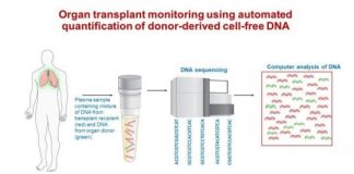 Study: New tool that uses DNA sequencing could improve transplant outcomes and save lives — (Details)