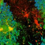 Study: Altered astrocytes may be the root of epilepsy development — (Details)