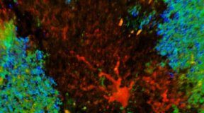 Study: Altered astrocytes may be the root of epilepsy development — (Details)
