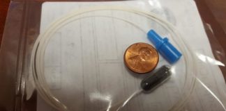 Study: A tiny capsule, a string and a 2-centimeter sponge are the future of screening for deadly disease — (Details)