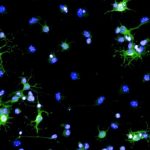 Study: Researchers decipher one of the body’s brain regeneration mechanisms — (Details)