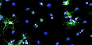 Study: Researchers decipher one of the body’s brain regeneration mechanisms — (Details)