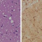 Study: Proof-of-concept study demonstrates test’s preclinical utility — (Details)