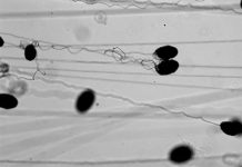 Research: Unraveling the mysteries of hagfish’s slimy defense —