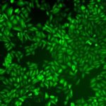 Study: A promising drug slows cancer’s circadian clock, halts its spread — (Details)