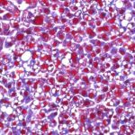 Study: Causes of cortisone-induced side effects — (Details)