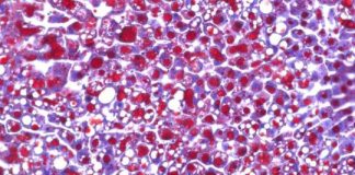 Study: Causes of cortisone-induced side effects — (Details)