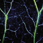 Study: Non-invasive, 3D-imaging tool measures blood flow and oxygenation — (Details)