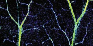 Study: Non-invasive, 3D-imaging tool measures blood flow and oxygenation — (Details)