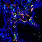 Study: Cells that destroy the intestine — (Details)