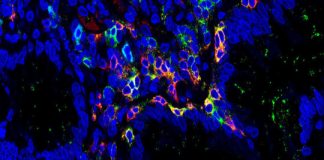 Study: Cells that destroy the intestine — (Details)