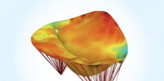 Study: New heart valve modeling technique enables customized medical care for patients — (Details)