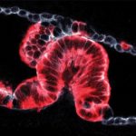 Study: New 3D imaging technique reveals how pancreatic cancers start — (Details)