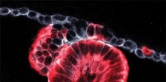 Study: New 3D imaging technique reveals how pancreatic cancers start — (Details)