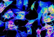 Tech: When the structure of tunneling nanotubes (TNTs) challenges the very concept of cell — (Report)