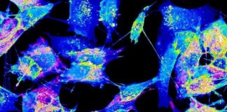 Tech: When the structure of tunneling nanotubes (TNTs) challenges the very concept of cell — (Report)