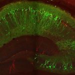 Study: Pinpointing the cells that control the brain’s memory flow — (Details)