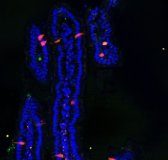 Study: Tweaking hormone-producing cells in the intestine — (Details)