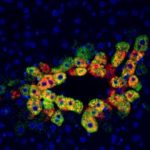 Study: Serendipitous observation opens the door for a precision medicine treatment — (Details)